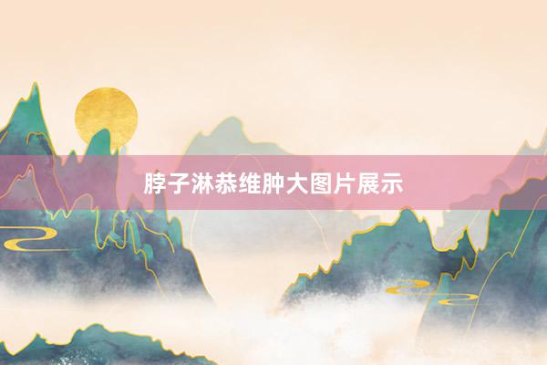 脖子淋恭维肿大图片展示